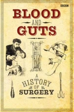 From the pioneering work of Galen on Roman gladiators to the latest advances in plastic surgery, this five-part series illustrates the evolution of surgical techniques—a story as much of mishaps and misadventures as it is of successes and amazing advances. Filmed in America and Europe and presented by the charismatic and medically trained Michael J. Mosley. Contains surgical scenes of a graphic nature. A BBC Production. 5-part series.