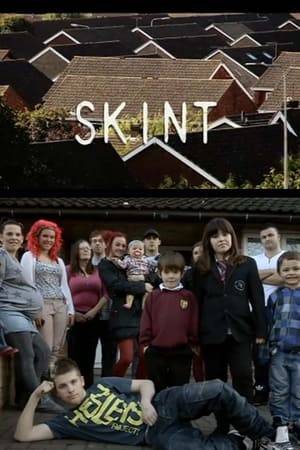 Skint is a documentary series which follows the lives of a group of unemployed people living in Scunthorpe, north Lincolnshire highlighting social issues such as crime, welfare dependency, truancy and addiction.